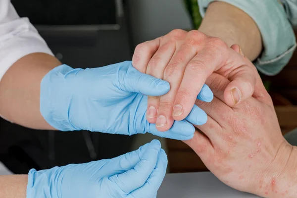 معاینه دست فرد برای انجام فرآیند جوانسازی پوست با تزریق ژل پروفایلو