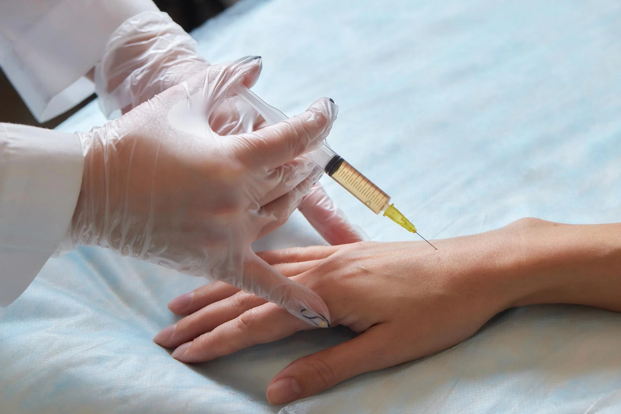 9 نکته ضروری درباره "جوانسازی دست با تزریق ژل"